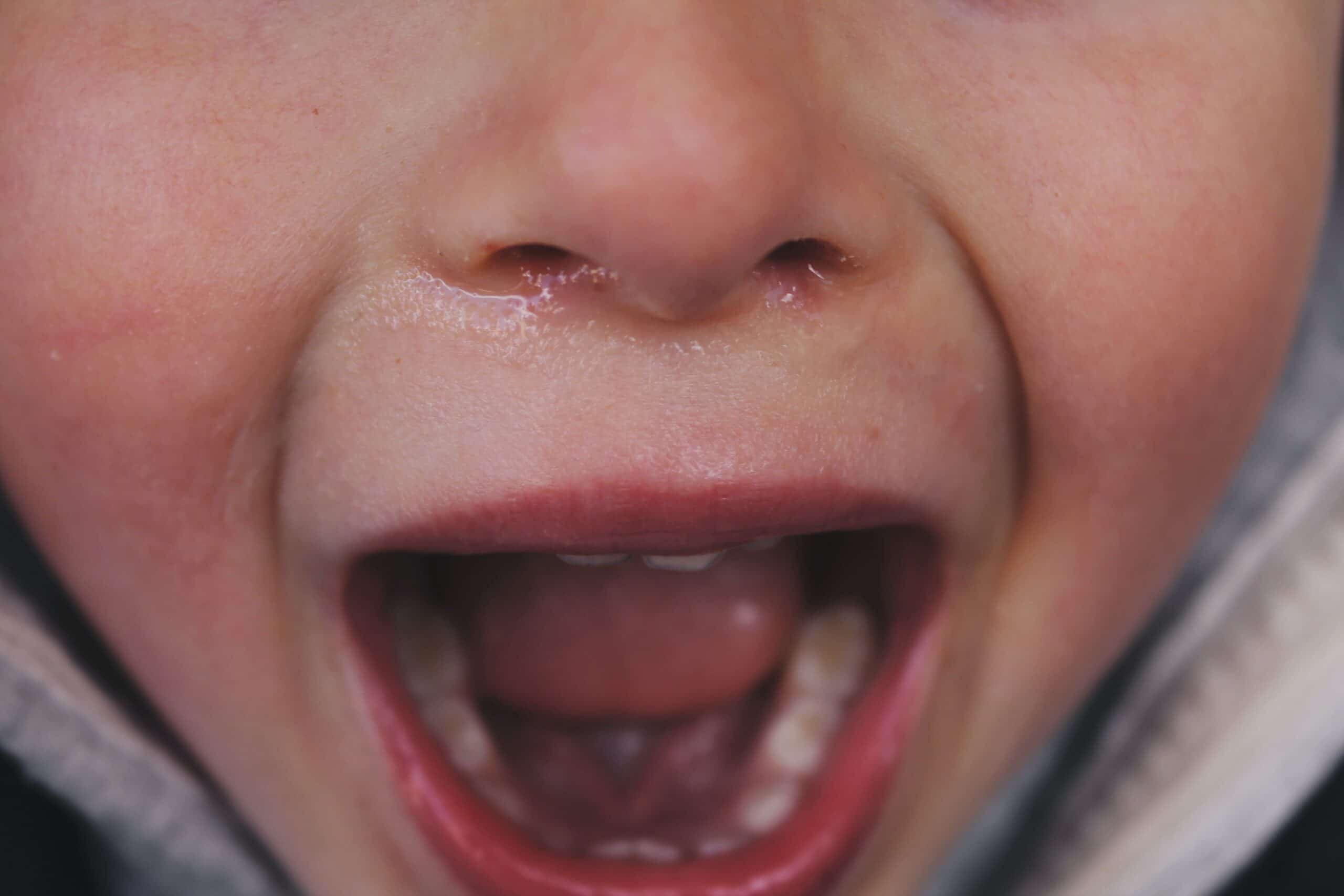 Photo of crying child by Marco Albuquerque for Unsplash